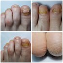 Nail Profi